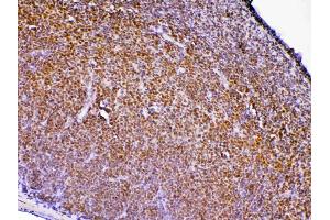 Immunohistochemistry (IHC) image for anti-Tyrosine-Protein Phosphatase Non-Receptor Type 22 (PTPN22) (AA 1-309) antibody (ABIN5693124)