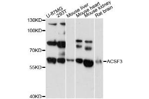 Western blot analysis of extracts of various cell lines, using ACSF3 antibody (ABIN6292804) at 1:3000 dilution. (ACSF3 抗体)