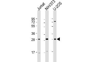 All lanes : Anti-SIX1 Antibody (Center) at 1:2000 dilution Lane 1: Jurkat whole cell lysate Lane 2: NIH/3T3 whole cell lysate Lane 3: U-2OS whole cell lysate Lysates/proteins at 20 μg per lane. (SIX Homeobox 1 抗体  (AA 69-102))