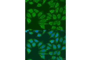 Immunofluorescence analysis of U2OS cells using  antibody (ABIN6131173, ABIN6136581, ABIN6136582 and ABIN6223850) at dilution of 1:100. (ADH7 抗体  (AA 1-386))