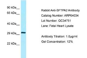 Western Blotting (WB) image for anti-Surfactant Associated Protein A2 (SFTPA2) (N-Term) antibody (ABIN2789704) (SFTPA2 抗体  (N-Term))