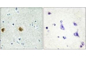 Immunohistochemistry analysis of paraffin-embedded human brain tissue, using NDUC2 Antibody.