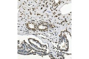IHC analysis of HP1 alpha/CBX5 using anti-HP1 alpha/CBX5 antibody (ABIN7599058).