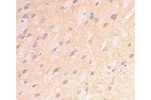 Immunohistochemical staining of rat brain using AP30071PU-N APP antibody at 2 μg/ml. (APP 抗体  (C-Term))