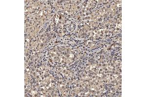 IHC analysis of SNRPA1 using anti-SNRPA1 antibody (ABIN7599131).