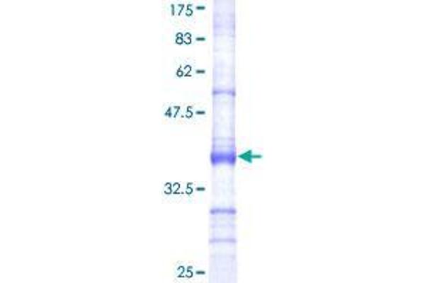 USP18 Protein (AA 273-372) (GST tag)