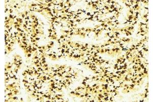 ABIN6277126 at 1/100 staining Human lung tissue by IHC-P. (MALT1 抗体  (Internal Region))