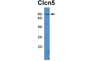 Host:  Rabbit  Target Name:  Clcn5  Sample Type:  Mouse Liver  Antibody Dilution:  1.