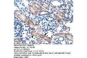 Human kidney (CLIC1 抗体  (N-Term))