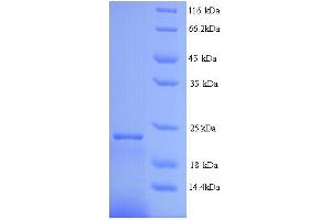SDS-PAGE (SDS) image for Interferon, alpha 2 (IFNA2) (AA 24-188) protein (His tag) (ABIN5714192)