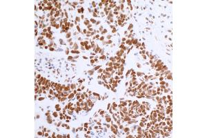 Immunohistochemistry (IHC) image for anti-Bromodomain Containing 4 (BRD4) (AA 1312-1362) antibody (ABIN7454041)