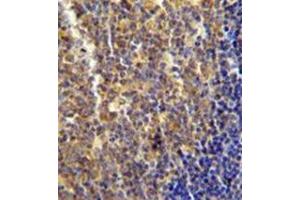 Immunohistochemistry analysis in formalin fixed and paraffin embedded human tonsil tissue reacted with LYRM4 Antibody (Center) followed which was peroxidase conjugated to the secondary antibody and followed by DAB staining. (LYRM4 抗体  (Middle Region))