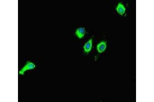 Immunofluorescent analysis of Hela cells using ABIN7160851 at dilution of 1:100 and Alexa Fluor 488-congugated AffiniPure Goat Anti-Rabbit IgG(H+L) (SIRT1 抗体  (AA 2-747))