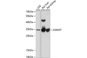 Western blot analysis of extracts of various cell lines using AGMAT Polyclonal Antibody at dilution of 1:1000. (AGMAT 抗体)