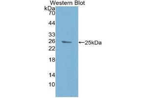 Western Blotting (WB) image for anti-B-Cell CLL/lymphoma 9 (BCL9) (AA 1119-1328) antibody (ABIN3201061) (BCL9 抗体  (AA 1119-1328))