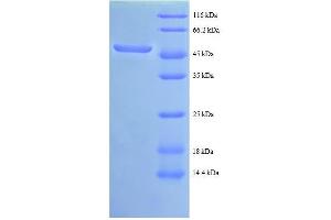 C-Abl Oncogene 1, Non-Receptor tyrosine Kinase (ABL1) (AA 4-194), (partial) protein (GST tag) (ABL1 Protein (AA 4-194, partial) (GST tag))