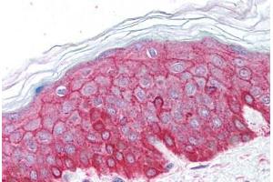 Human Skin (formalin-fixed, paraffin-embedded) stained with ACTB antibody ABIN213653 at 5 ug/ml followed by biotinylated goat anti-rabbit IgG secondary antibody ABIN481713, alkaline phosphatase-streptavidin and chromogen. (beta Actin 抗体  (C-Term))