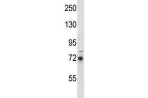 RIPK1 antibody western blot analysis in MDA-MB231 lysate. (RIPK1 抗体  (AA 152-180))