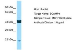 Image no. 1 for anti-Secretory Carrier Membrane Protein 4 (SCAMP4) (AA 41-90) antibody (ABIN6750134) (SCAMP4 抗体  (AA 41-90))