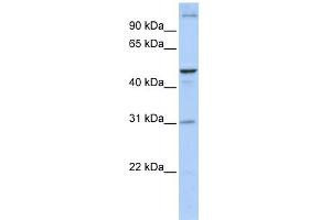 WB Suggested Anti-ACBD5 Antibody Titration:  0. (ACBD5 抗体  (N-Term))