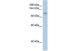 PRPF6 antibody used at 2. (PRP6/ANT-1 抗体)