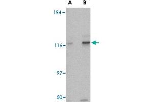 Western blot analysis of KIF5A in K-562 cell lysate with KIF5A polyclonal antibody  at (A) 0. (KIF5A 抗体  (AA 330-380))
