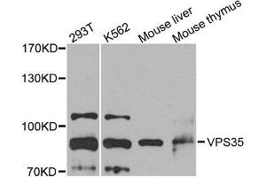 Western blot analysis of extracts of various cell lines, using VPS35 antibody. (VPS35 抗体  (AA 1-250))