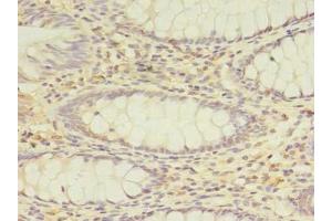 Immunohistochemistry (IHC) image for anti-Peroxisomal Biogenesis Factor 11 beta (PEX11B) (AA 9-228) antibody (ABIN7162969)