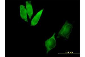 Immunofluorescence of purified MaxPab antibody to DYNC1I2 on HeLa cell.