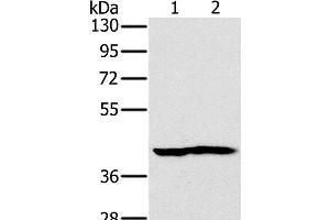 Western Blot analysis of Mouse heart and kidney tissue using NDUFA10 Polyclonal Antibody at dilution of 1:450 (NDUFA10 抗体)