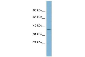 GDF15 antibody used at 1 ug/ml to detect target protein. (GDF15 抗体  (N-Term))