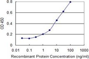 Detection limit for recombinant GST tagged ULK2 is 0. (ULK2 抗体  (AA 743-843))