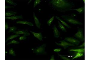 Immunofluorescence of monoclonal antibody to NMNAT2 on HeLa cell. (NMNAT2 抗体  (AA 1-302))