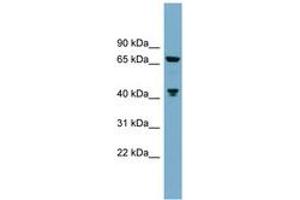 Image no. 1 for anti-Glutaminase (GLS) (C-Term) antibody (ABIN6743797) (Glutaminase 抗体  (C-Term))