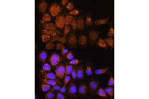 Immunofluorescence analysis of HeLa cells using SYNE3 Rabbit pAb (ABIN6131129, ABIN6148766, ABIN6148767 and ABIN6217163) at dilution of 1:100. (Nesprin3 抗体  (AA 740-920))