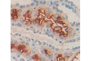 Used in DAB staining on fromalin fixed paraffin- embedded Kidney tissue (LETMD1 抗体  (AA 162-347))