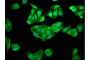 Immunofluorescence staining of HepG2 cells with ABIN7147628 at 1:100, counter-stained with DAPI. (CHKB 抗体  (AA 2-99))