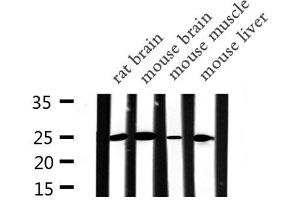 Western blot analysis of APOA1 expression in various lysates (APOA1 抗体  (N-Term))