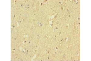 Immunohistochemistry (IHC) image for anti-Protein tyrosine Phosphatase, Receptor-Type, Z Polypeptide 1 (PTPRZ1) (AA 36-300) antibody (ABIN7167522)