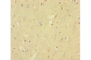 Immunohistochemistry of paraffin-embedded human brain tissue using ABIN7167522 at dilution of 1:100 (PTPRZ1 抗体  (AA 36-300))