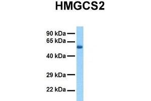 Host:  Rabbit  Target Name:  HMGCS2  Sample Tissue:  Human Fetal Liver  Antibody Dilution:  1. (HMGCS2 抗体  (N-Term))
