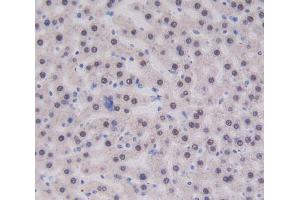 IHC-P analysis of liver tissue, with DAB staining. (CUBN 抗体  (AA 3511-3623))