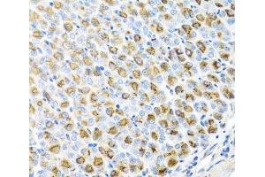 Immunohistochemistry of paraffin-embedded Mouse stomach using FECH Polyclonal Antibody at dilution of 1:100 (40x lens). (FECH 抗体)