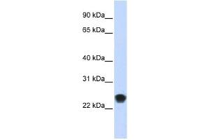 FKBP11 antibody used at 1 ug/ml to detect target protein. (FKBP11 抗体  (N-Term))