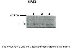 Lanes:   1. (SIRT2 抗体  (C-Term))