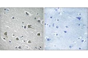 Immunohistochemistry (IHC) image for anti-Myosin Regulatory Light Chain Interacting Protein (MYLIP) (AA 161-210) antibody (ABIN2890287) (MYLIP 抗体  (AA 161-210))