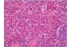 Thymus stained with Cellubrevin antibody in Immunohistochemistry on Paraffin Sections. (VAMP3 抗体  (N-Term))