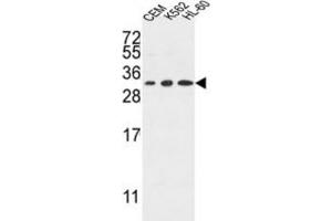 Western Blotting (WB) image for anti-Tetraspanin 2 (TSPAN2) antibody (ABIN3004129) (Tetraspanin 2 抗体)