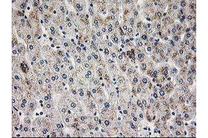 Immunohistochemical staining of paraffin-embedded Human liver tissue using anti-PGAM2 mouse monoclonal antibody. (PGAM2 抗体)