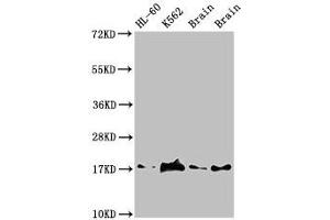 Western Blot Positive WB detected in: HL60 whole cell lysate, K562 whole cell lyaste, Mouse brain tissue, Rat brain tissue All lanes: UBE2V2 antibody at 1. (UBE2V2 抗体  (AA 2-145))